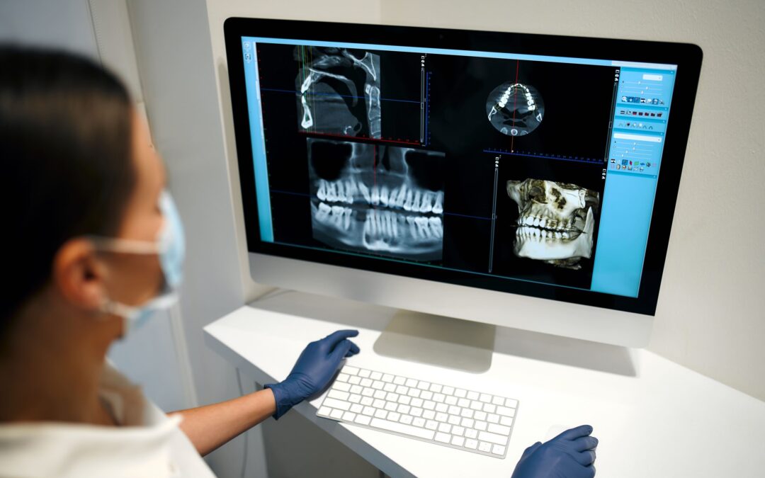 Com la tecnologia CBCT està revolucionant l’odontologia a Lleida